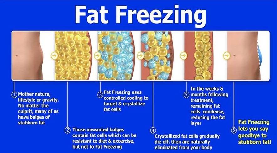 Fat-freeze-info-2018